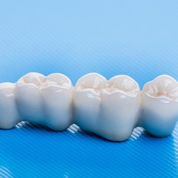 A closeup of a dental bridge set against a blue background