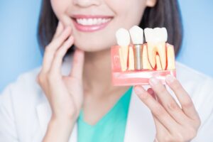 smiling woman holding a model of a dental implant